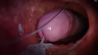 China Twink XXX Tube 6